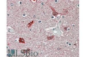 ABIN570984 (3. (CaMKII alpha/beta (Internal Region) 抗体)