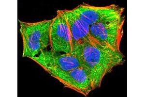 Immunofluorescence (IF) image for anti-Mitogen-Activated Protein Kinase Kinase 3 (MAP2K3) (AA 1-138) antibody (ABIN5542528)