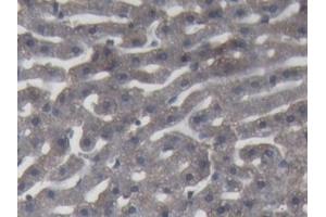 Detection of C9 in Rabbit Liver Tissue using Polyclonal Antibody to Complement Component 9 (C9) (C9 抗体  (AA 139-519))