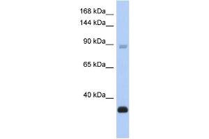 WB Suggested Anti-BCL11B Antibody Titration:  0. (BCL11B 抗体  (Middle Region))