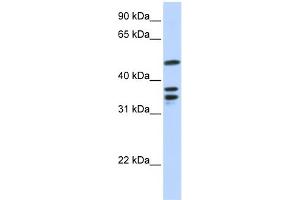 WB Suggested Anti-ETV6 Antibody Titration:  0. (ETV6 抗体  (N-Term))