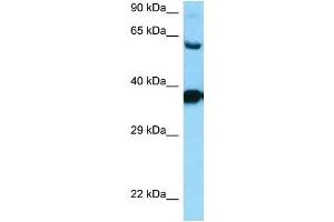 WB Suggested Anti-DRD3 Antibody Titration: 1. (DRD3 抗体  (C-Term))