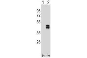 Western Blotting (WB) image for anti-Dual Specificity Phosphatase 6 (DUSP6) (AA 59-88) antibody (ABIN3030776)