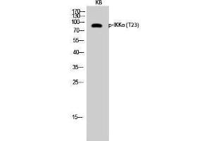 Western Blotting (WB) image for anti-conserved Helix-Loop-Helix Ubiquitous Kinase (CHUK) (pThr23) antibody (ABIN3172912) (IKK alpha 抗体  (pThr23))