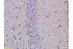 Immunohistochemistry (Paraffin-embedded Sections) (IHC (p)) image for anti-Glial Fibrillary Acidic Protein (GFAP) (AA 51-150) antibody (ABIN726200)