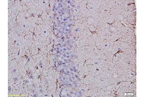Formalin-fixed and paraffin embedded: rat brain tissue Anti-GFAP Polyclonal Antibody, Unconjugated  at 1:400, followed by conjugation to the secondary antibody and DAB staining (GFAP 抗体  (AA 51-150))