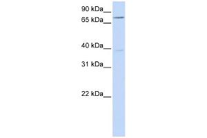 WB Suggested Anti-C17orf80 Antibody Titration:  0. (HLC8 抗体  (N-Term))