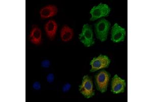 ITIH1 Antibody staining Hela cells by IF/ICC. (ITIH1 抗体  (Internal Region))