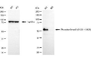 Western blotting analysis using phospho-Smad3 (S423 + S425) antibody (ABIN7800373). (Recombinant SMAD3 抗体  (pSer423, pSer425))