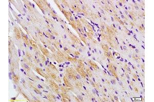 Formalin-fixed and paraffin embedded rat heart labeled with Anti-Titin/CMD1G Polyclonal Antibody, Unconjugated  at 1:200 followed by conjugation to the secondary antibody and DAB staining. (Titin 抗体  (AA 2670-2703))