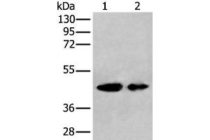 Western blot analysis of A549 and HEPG2 cell lysates using VASP Polyclonal Antibody at dilution of 1:400 (VASP 抗体)