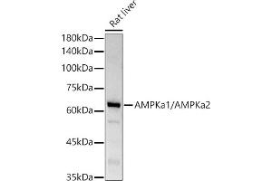 Western blot analysis of extracts of Rat liver, using AMPKa1/AMPKa2 antibody (ABIN6129902, ABIN6136848, ABIN6136849 and ABIN7101410) at 1:1000 dilution.