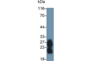 Detection of ZG16B in Human Saliva using Polyclonal Antibody to Zymogen Granule Protein 16 Homolog B (ZG16B) (ZG16B 抗体  (AA 53-208))