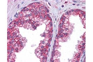 Immunohistochemistry (IHC) image for anti-Signal Transducer and Activator of Transcription 6, Interleukin-4 Induced (STAT6) (C-Term) antibody (ABIN927315)