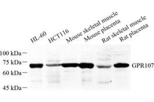 Western blot analysis of GPR107 (ABIN7073995) at dilution of 1: 500 (GPR107 抗体)