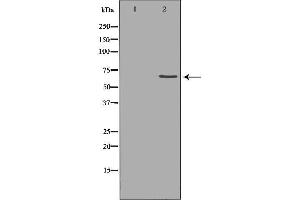 Western blot analysis of extracts of hela , using MMP14 antibody.