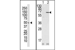 Image no. 1 for anti-Docking Protein 1, 62kDa (Downstream of tyrosine Kinase 1) (DOK1) (N-Term) antibody (ABIN359958) (DOK1 抗体  (N-Term))