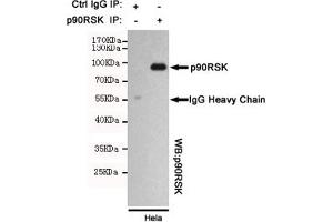 Immunoprecipitation analysis of Hela cell lysates using p90RSK mouse mAb. (RPS6KA3 抗体)