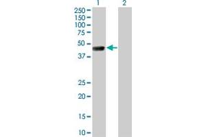 Western Blot analysis of TSSK1 expression in transfected 293T cell line by TSSK1 monoclonal antibody (M01), clone 4F12. (TSSK1B 抗体  (AA 267-367))
