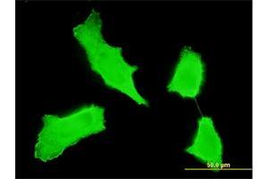 Immunofluorescence of monoclonal antibody to ERBB2 on HeLa cell. (ErbB2/Her2 抗体  (AA 22-121))