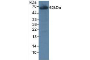 Detection of CES1 in Rat Liver Tissue using Polyclonal Antibody to Carboxylesterase 1 (CES1) (CES1 抗体  (AA 19-300))