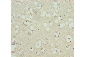 Immunohistochemistry of paraffin-embedded human brain tissue using ABIN7167840 at dilution of 1:100 (RDH12 抗体  (AA 182-316))