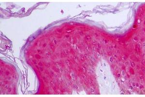 Anti-IL1RN / IL-1RA antibody IHC staining of human skin, epidermis.