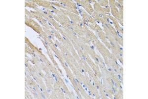Immunohistochemistry of paraffin-embedded rat heart using CRHBP antibody at dilution of 1:100 (40x lens). (CRHBP 抗体)