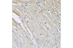 Immunohistochemistry of paraffin-embedded rat heart using CRHBP antibody at dilution of 1:100 (40x lens). (CRHBP 抗体)