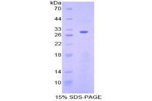 SDS-PAGE analysis of Human ATF6 Protein. (ATF6 蛋白)