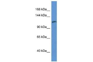 Western Blot showing INPP5D antibody used at a concentration of 1 ug/ml against THP-1 Cell Lysate
