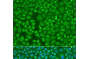 Immunofluorescence analysis of U2OS cells using LLGL2 Polyclonal Antibody at dilution of 1:100. (LLGL2 抗体)