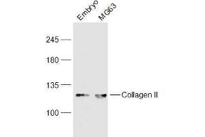 Western Blotting (WB) image for anti-Collagen, Type II, alpha 1 (COL2A1) (AA 231-330) antibody (ABIN2559415)