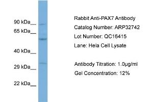 WB Suggested Anti-PAX7 Antibody Titration: 0. (PAX7 抗体  (C-Term))