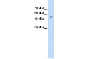 Human Jurkat; WB Suggested Anti-ZNF498 Antibody Titration: 1. (Zinc Finger and SCAN Domain Containing 25 (ZSCAN25) (Middle Region) 抗体)