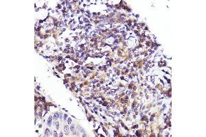 Immunohistochemistry (IHC) image for anti-C-Maf Inducing Protein (CMIP) antibody (ABIN7265970)