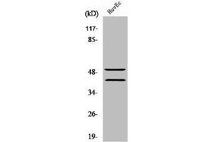 Western Blot analysis of Jurkat cells using TCF-1 Polyclonal Antibody (TCF7 抗体  (N-Term))