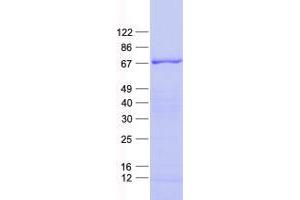 Western Blotting (WB) image for Zinc Finger Protein 543 (ZNF543) protein (His tag) (ABIN2736065)