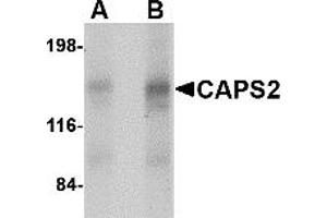 Western Blotting (WB) image for anti-Calcyphosine 2 (CAPS2) (Middle Region) antibody (ABIN1030895) (Calcyphosine 2 抗体  (Middle Region))