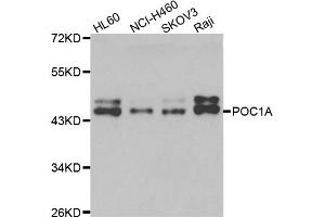 Western blot analysis of extracts of various cell lines, using POC1A antibody (ABIN5975553) at 1/1000 dilution. (POC1A 抗体)