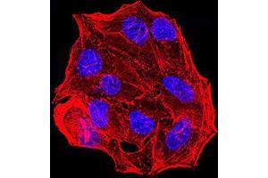Immunofluorescence analysis of Hela cells using ESR1 mouse mAb. (Estrogen Receptor alpha 抗体  (AA 2-185))