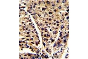 Immunohistochemistry (IHC) image for anti-Enolase 3 (Beta, Muscle) (ENO3) antibody (ABIN3001691) (ENO3 抗体)