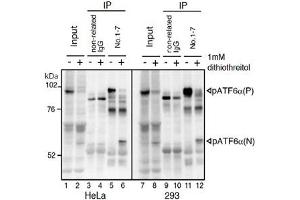 IP-Western blot analysis of human cell extracts using ATF6 monoclonal antibody, clone 1-7 . (ATF6 抗体  (N-Term))
