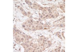 Immunohistochemistry (IHC) image for anti-Four and A Half LIM Domains 2 (FHL2) (C-Term) antibody (ABIN7453598)