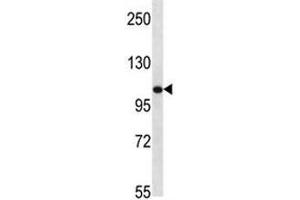 TLR8 antibody western blot analysis in mouse bladder tissue lysate (TLR8 抗体  (AA 957-987))