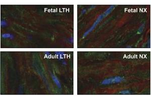 Expression of KCNMA1 in adult and fetal ovine arteriole myocytes.