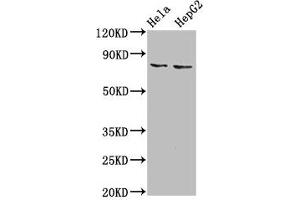 Western Blot Positive WB detected in: Hela whole cell lysate, HepG2 whole cell lysate All lanes: ESRP2 antibody at 6 μg/mL Secondary Goat polyclonal to rabbit IgG at 1/50000 dilution Predicted band size: 79, 78 kDa Observed band size: 79 kDa (ESRP2 抗体  (AA 615-720))