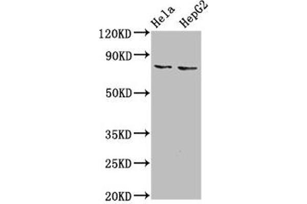 ESRP2 抗体  (AA 615-720)