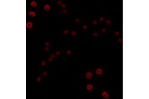 ABIN6266706 staining COLO205 by IF/ICC. (T-Box 1 抗体  (C-Term))