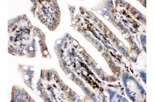 IHC analysis of PKC alpha using anti-PKC alpha antibody (ABIN3043549).